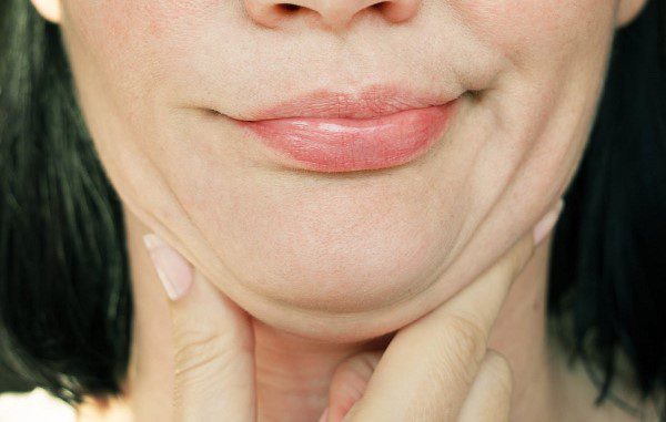 chin fat removal cost